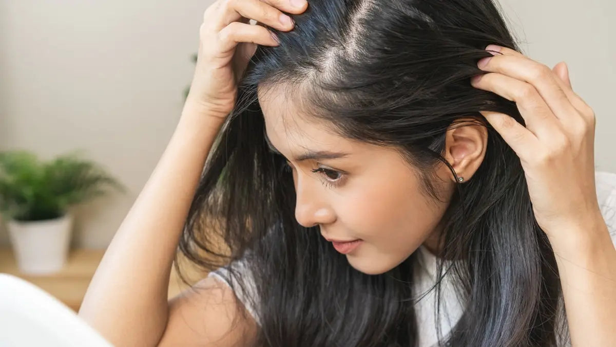 Apa Itu Pitak? Kenali Penyebab dan Cara Mengatasinya