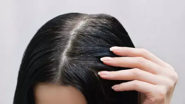 Penyebab Rambut Putih di Usia Muda dan Cara Mengatasinya