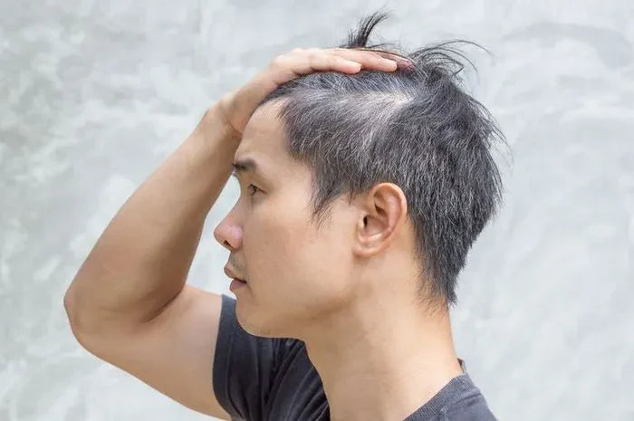 Rambut Patah Pria: Mungkinkah Terjadi Meski Rambut Pendek?