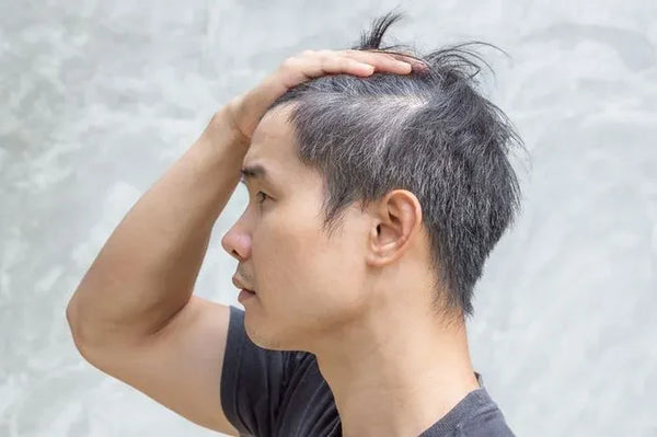 Rambut Patah Pria: Mungkinkah Terjadi Meski Rambut Pendek?