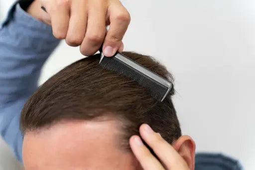 Cara Mengatasi Rambut Kaku dan Kering pada Pria