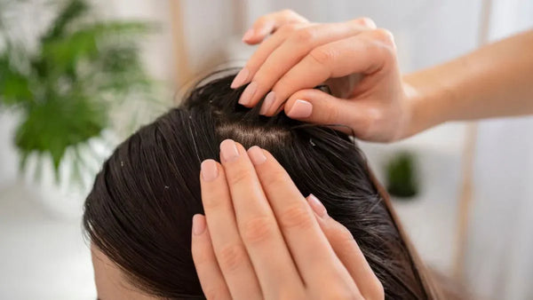Treatment Rambut Ketombe yang Efektif Tanpa Bikin Kulit Kepala Iritasi