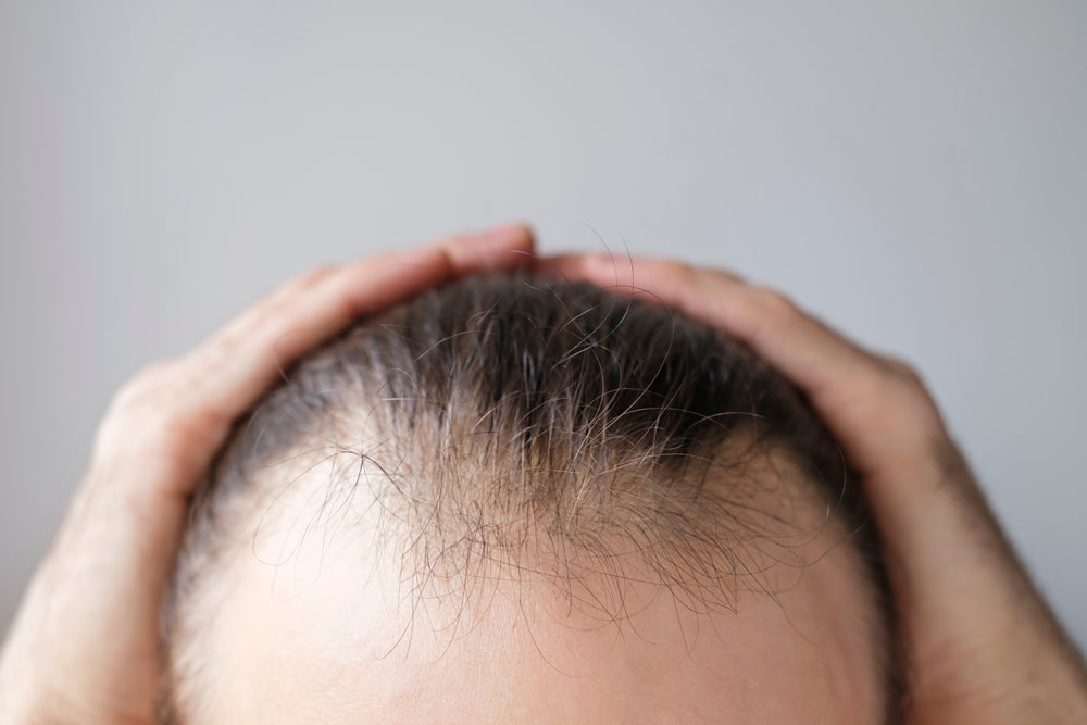 Cara Mengatasi Rambut Tipis: Solusi Tepat Agar Rambut Terlihat Lebih Tebal dan Sehat