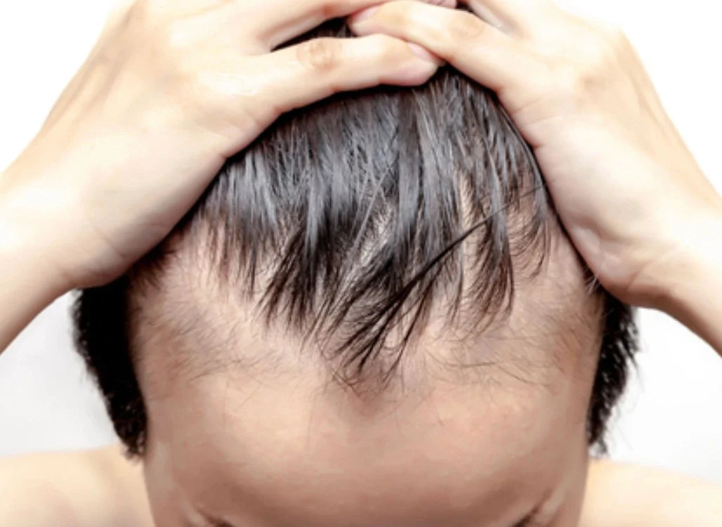 Cara Mempercepat Pertumbuhan Rambut Pria