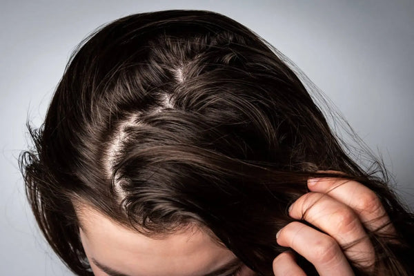 Rambut Berminyak Tapi Ujung Kering? Ini Solusinya