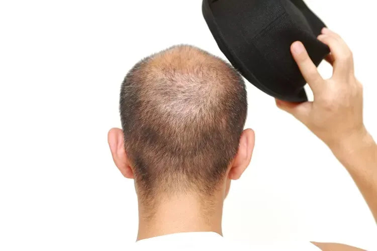 cara menumbuhkan rambut dengan cepat dan alami