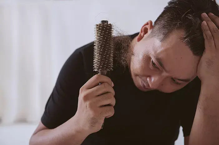 Penyebab Rambut Rontok pada Pria di Usia Muda: Kenali dan Atasi Sejak Dini