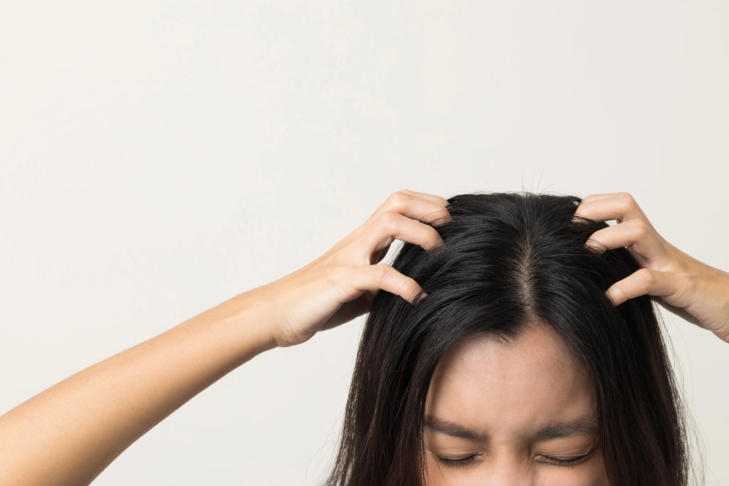Jerawat di Kulit Kepala? Ini Penyebab dan Cara Mengatasinya