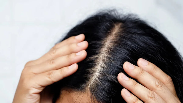 Cara Membersihkan Kulit Kepala: Tips dan Trik untuk Rambut Sehat