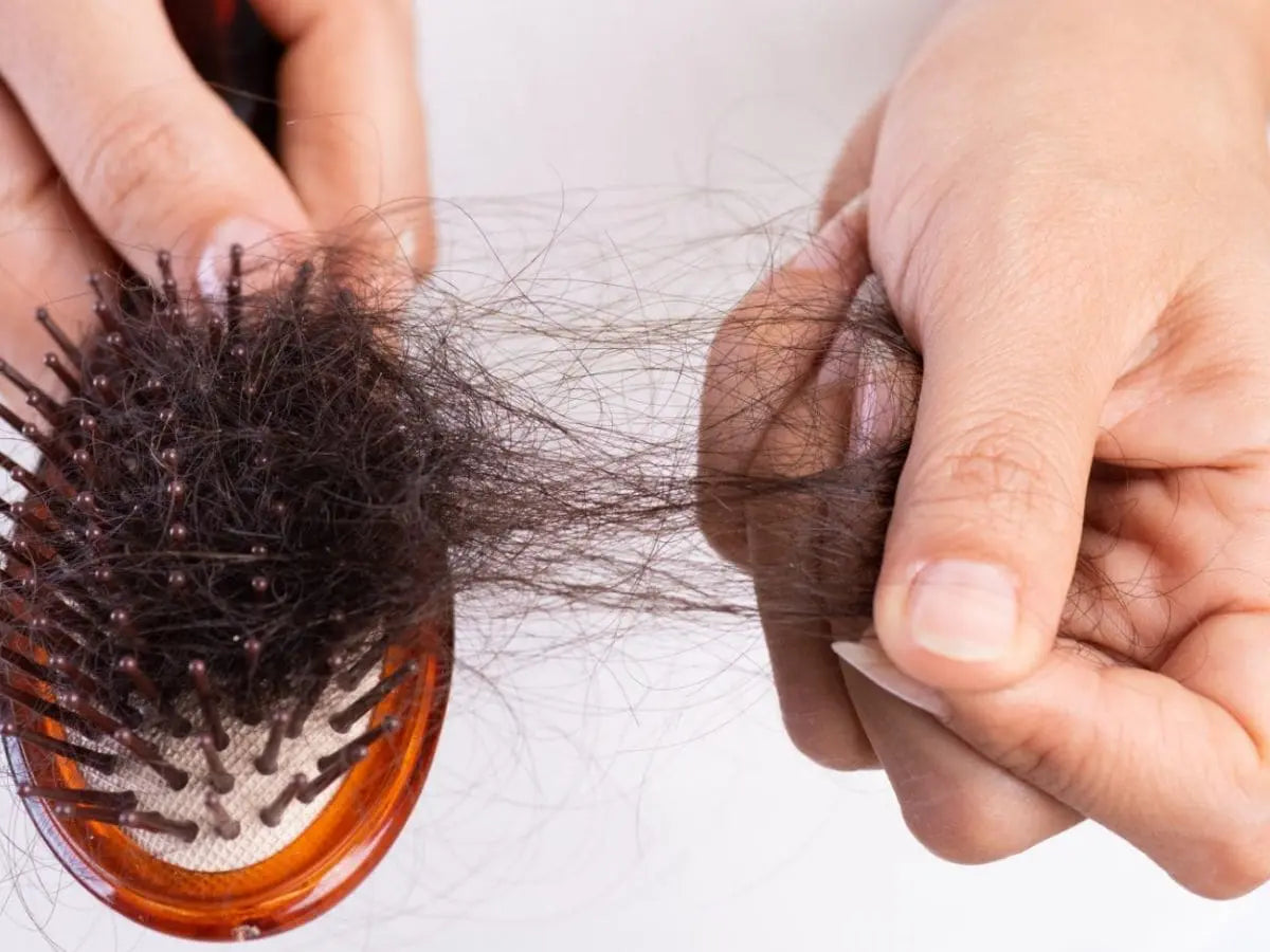 Cara Mengatasi Rambut Rontok Akibat Hormon Tiroid