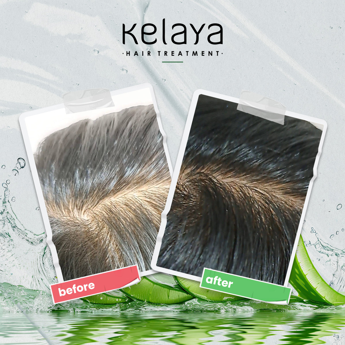Before After Pemakaian Kelaya