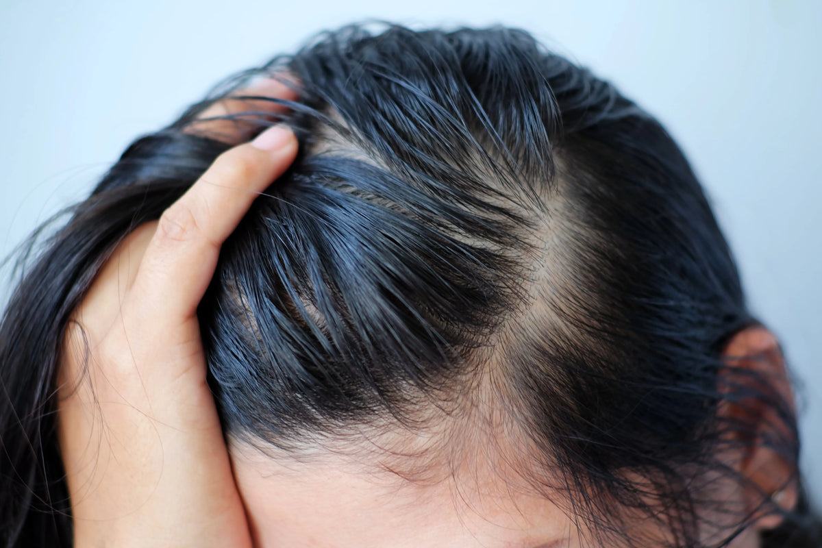 Tidak Perlu Panik, Ini Langkah Mudah Cara Menghilangkan Rambut Lepek! 