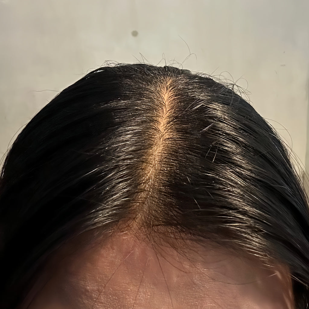 Cara Mengatasi Rambut Berminyak: Tips Alami untuk Rambut Sehat