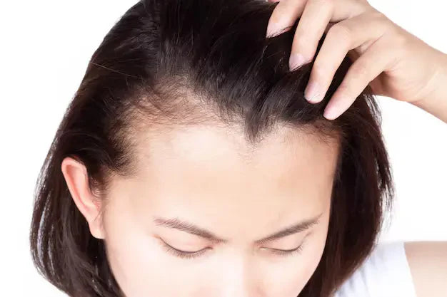 Stres dan Rambut Rontok: Hubungan dan Cara Mengatasinya
