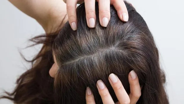 Rambut Tiba-Tiba Pitak, Kira-Kira Apa Penyebabnya?