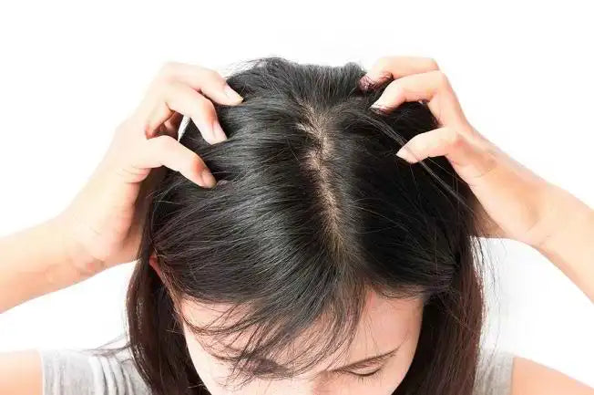 Shampo untuk Kulit Kepala Kering yang Bikin Rambut Tidak Gampang Rontok