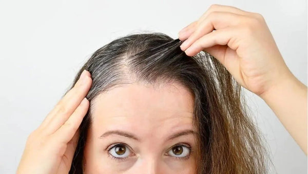 Penyebab-Kebotakan-Berpola-pada-Wanita