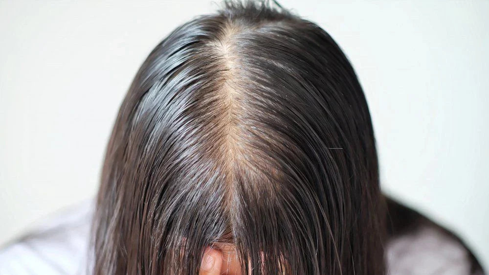 Apakah Folikel Rambut Bisa Tumbuh Kembali? Ini Penjelasannya