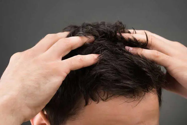 Rambut Kering dan Mengembang Pria? Ini Solusinya!
