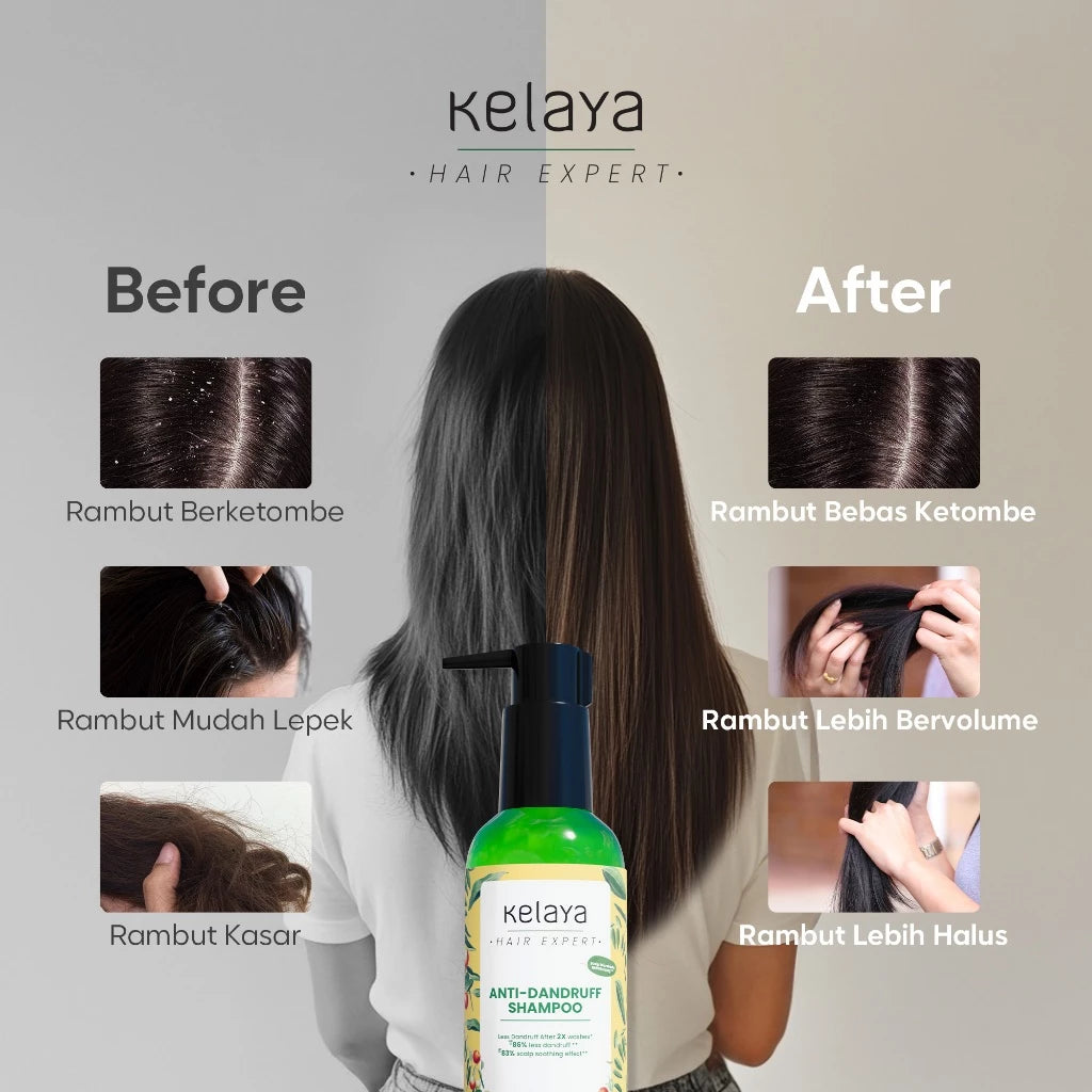 Kelaya Anti-Dandruff Shampoo 100ml Sampo ketombe Non SLS Perawatan Rambut Anti Ketombe Expert