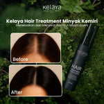 Kelaya Minyak Kemiri 50 ml Penumbuh Rambut Botak Perawatan Anti Rontok