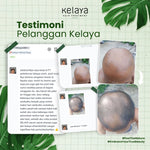 Kelaya Hair Serum 100 ml Penumbuh Rambut Rontok Kering
