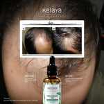 Kelaya Hair Expert Rosemary Oil 50ml 3X Lebih Ampuh Dari Minoxidil Penumbuh Rambut Rontok & Kering