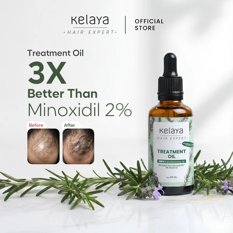 Kelaya Hair Expert Rosemary Oil 50ml 3X Lebih Ampuh Dari Minoxidil Penumbuh Rambut Rontok & Kering