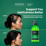 Kelaya Shampo Anti Ketombe dan Rambut Rontok 250ml, Penumbuh Rambut Anti Ketombe Anti Rontok